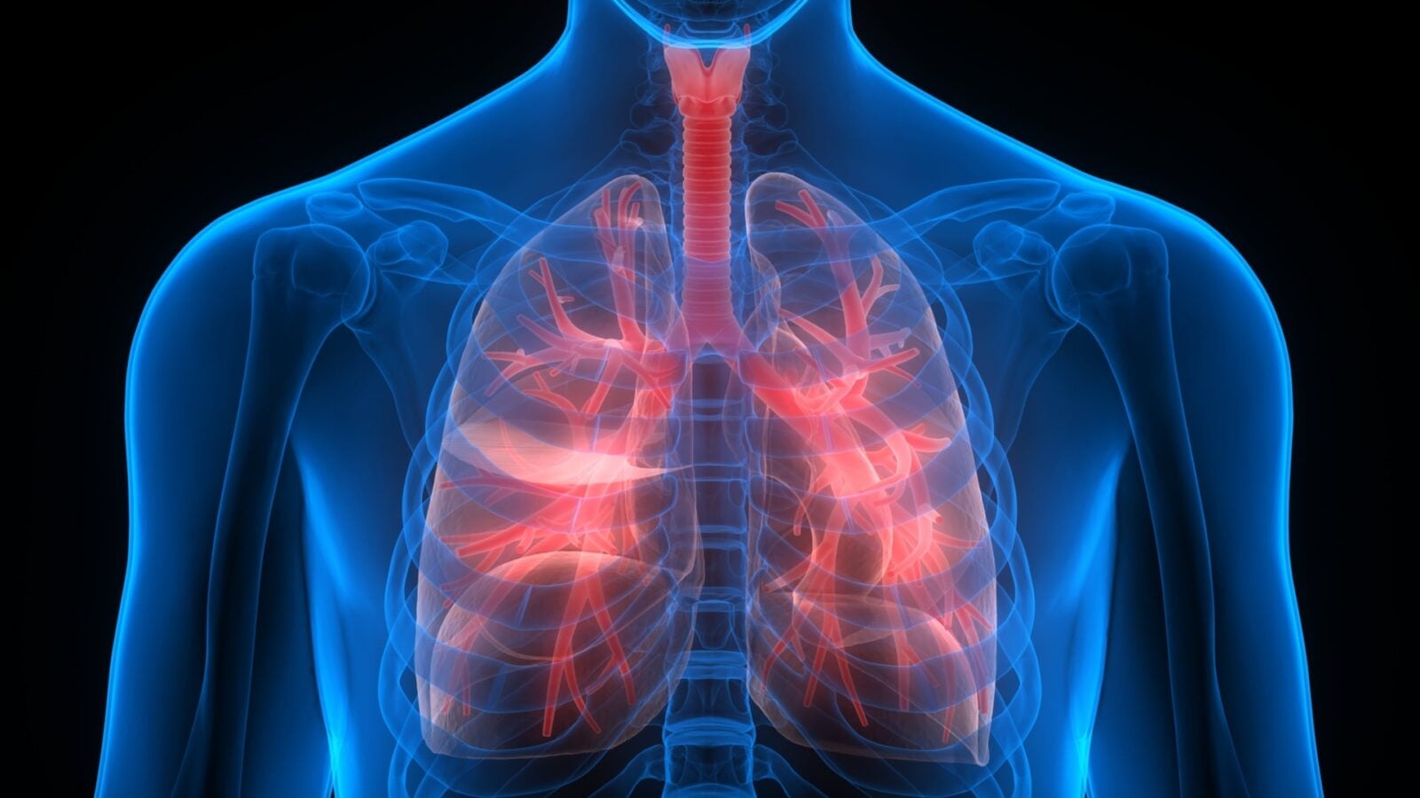 Lung Collapses Are A Surprisingly Common Esports Injury - Kotaku