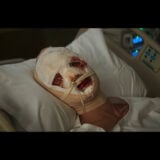 A still from the upcoming DCU film Clayface showing the main character in a hospital with his head wrapped in bandages, staring vacantly at the camera