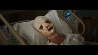 A still from the upcoming DCU film Clayface showing the main character in a hospital with his head wrapped in bandages, staring vacantly at the camera