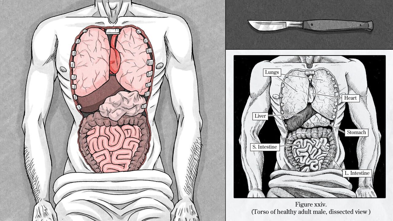 Edwin Earstwhile: Medical Examiner