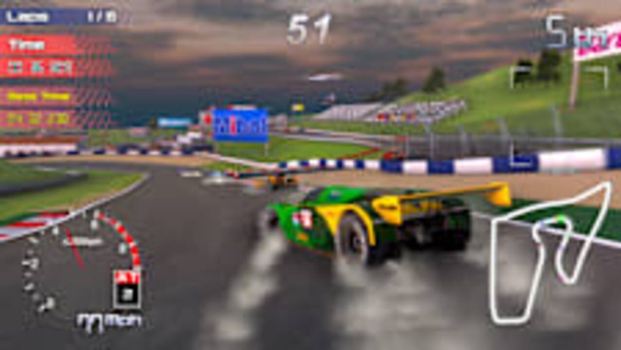 Rally & Hypercar Bundle