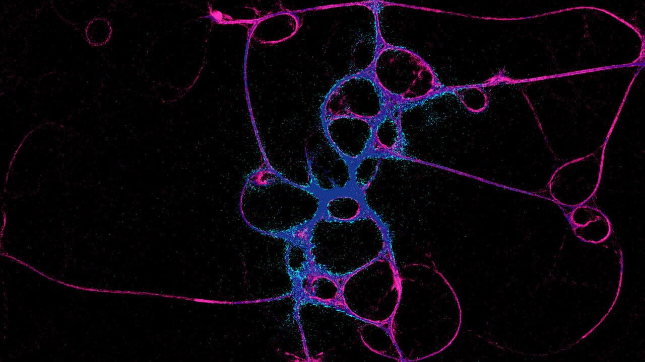 Physarum: Slime Mold Simulator