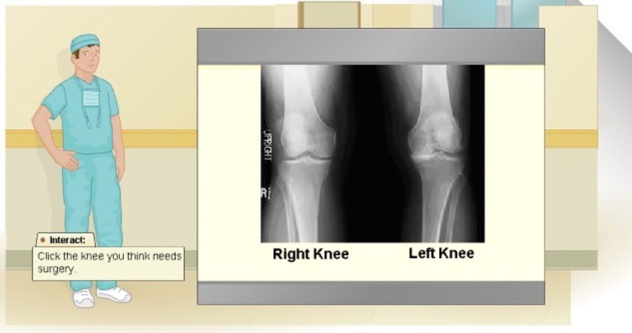 Virtual Knee Surgery