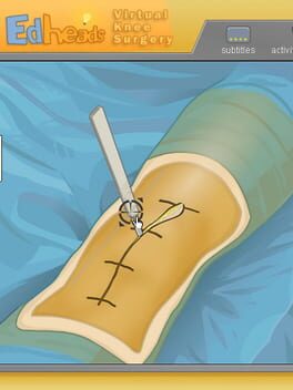 Virtual Knee Surgery