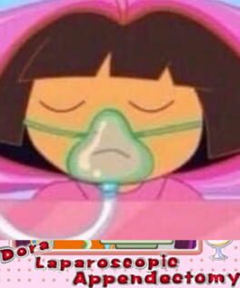 Dora Laparoscopic Appendectomy