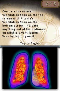 House M.D. Episode 5: Under the Big Top