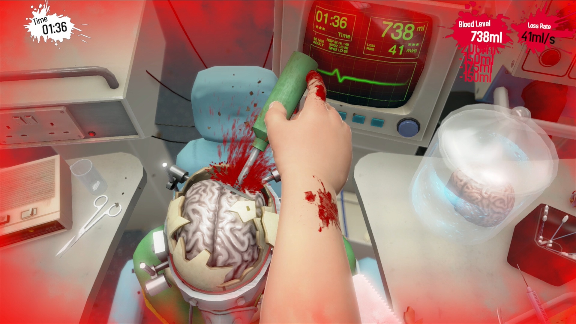 Surgeon Simulator: Anniversary Edition