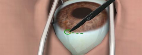Surgery Simulator