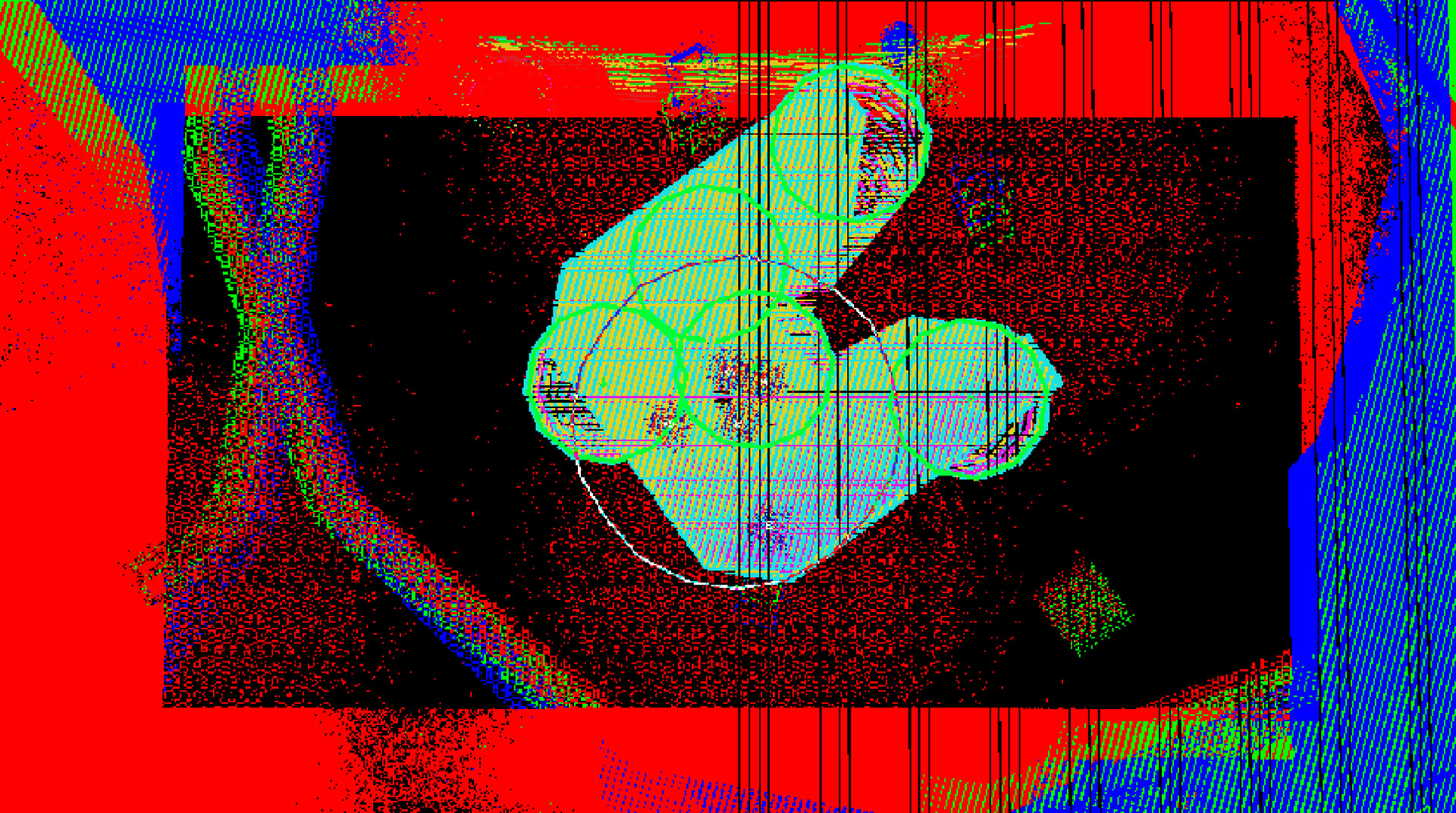 Nerve Damage