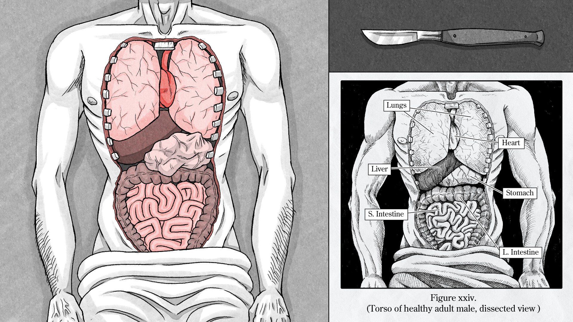 Edwin Earstwhile: Medical Examiner