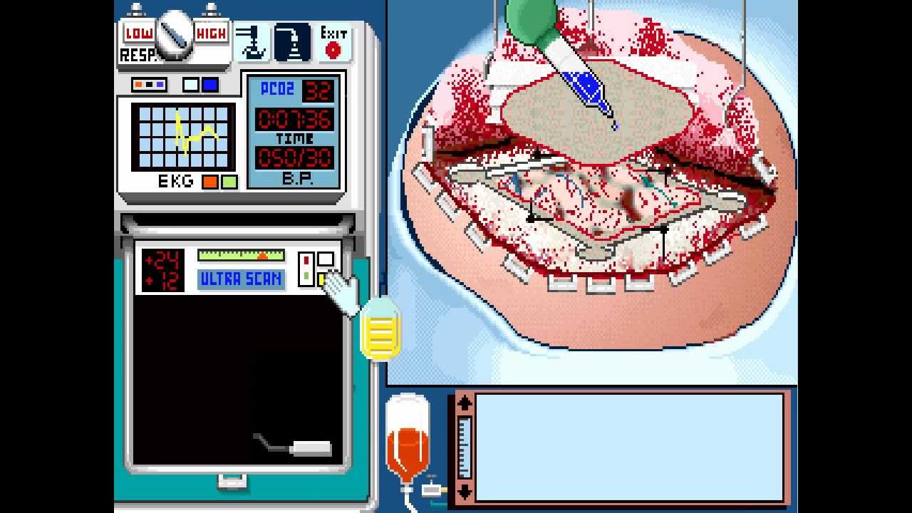 Life &amp; Death II: The Brain