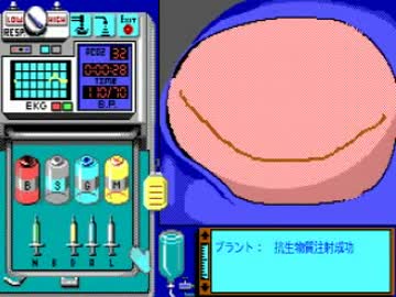 Life &amp; Death II: The Brain