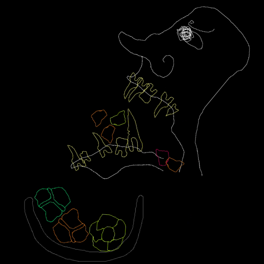Teeth Simulator