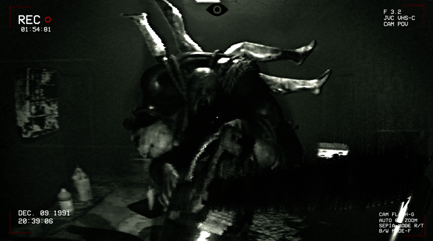 Durium Hospital Lost Tape 95