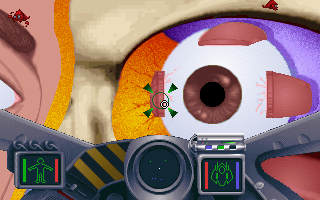 Bodyworks Voyager: Mission in Anatomy